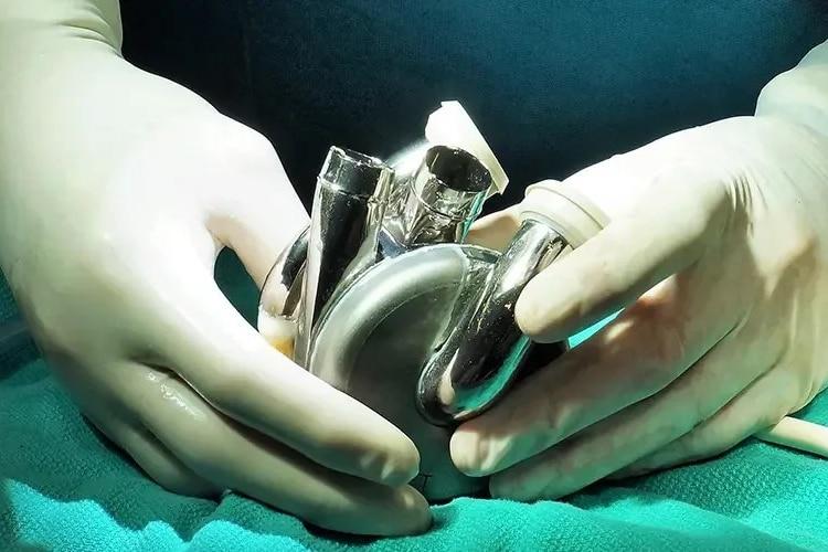 Một bệnh nh&acirc;n &Uacute;c đ&atilde; trở th&agrave;nh người đầu ti&ecirc;n tr&ecirc;n thế giới xuất viện với tr&aacute;i tim nh&acirc;n tạo